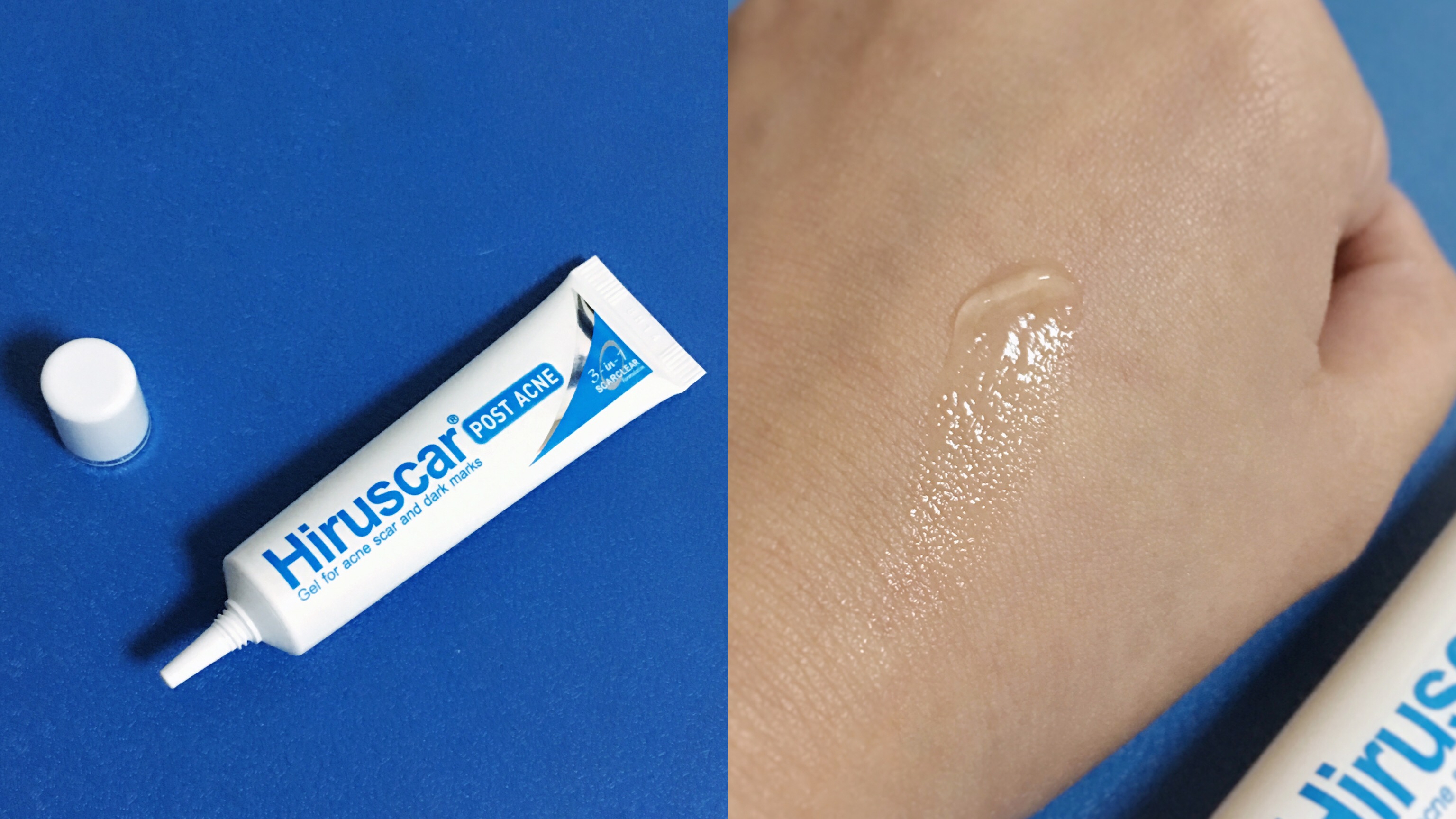 喜能復「青春抗菌祛印凝膠」淡化瑕疵、改善出油，還我清白好皮膚！